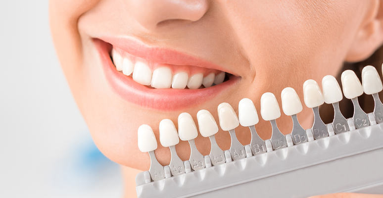 slide-teeth-whitening